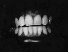 teethcropsm.gif