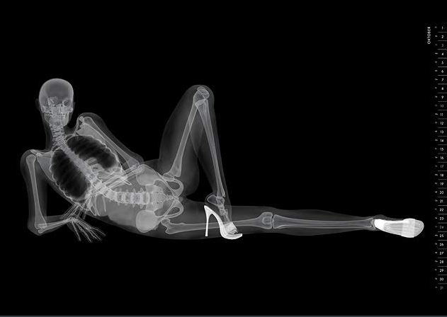 xray