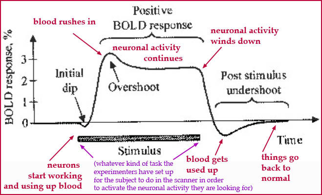 BOLD response diagram