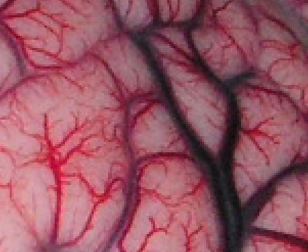 vasculature in the brain (better)
