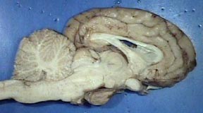 brain 4