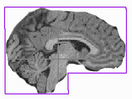 homework_brain5